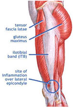 Illiotibial Band