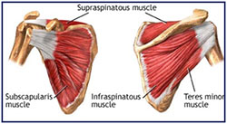 Swimmer's Shoulder 